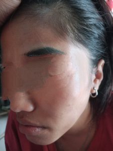 Diduga Ditolak Lapor KDRT di Cisauk, Perempuan Mengadu Propam